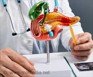 Link Between Insulin, Obesity, and Pancreatic Cancer
