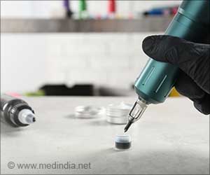 Intradermal Smart Tattoos can Help in Detecting Systemic Diseases