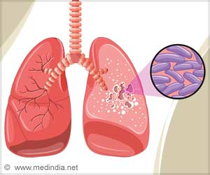 Enhancing Immunity to Combat Tuberculosis