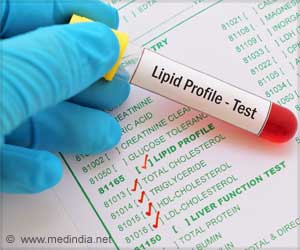Guidelines for Lipid Monitoring in Endocrine Disorders Updated