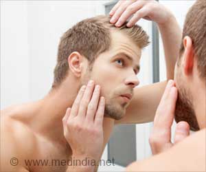 Do Men Experience Increased Hair Loss in Summer?