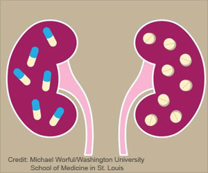 Commonly Used Heartburn Drugs Can Lead to Gradual Yet ‘Silent’ Kidney Damage