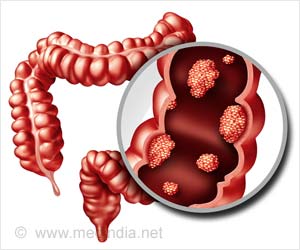 Detecting Lynch Syndrome Among Colorectal Cancer (CRC) Patients