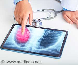  Lung Cancer Awareness Month Matters