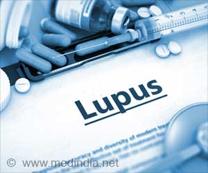 Why Lupus Targets Women? Understanding the Female Predilection