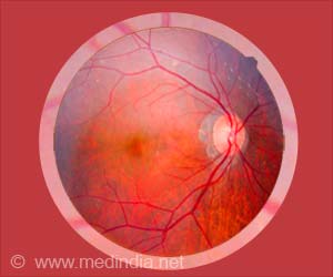 Diabetic Retinopathy Can Worsen With Low Blood Sugar Levels