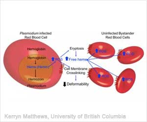 New Malaria Analysis Method Quickly Assesses Disease Severity