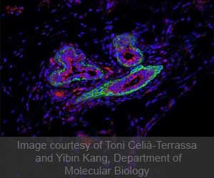 RNA Molecule Identified to Shield Breast Cancer Stem Cells RNA Molecule Identified to Shield Breast Cancer Stem Cells