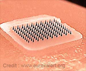 Microneedle Patch to Deliver Influenza Vaccine  A Peek into the Future?