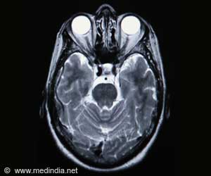 1 in 5 Medicare Recipients Travel Over 50 Miles for Neurologist Visits 1 in 5 Medicare Recipients Travel Over 50 Miles for Neurologist Visits