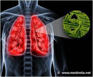 Prevention Treatment Beneficial for Children Exposed to Multidrug Resistant Tuberculosis Bacterium