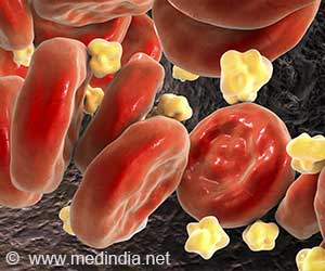 Scientists Discover How to Turn Up Your Body's Natural Fat-Burning Power!