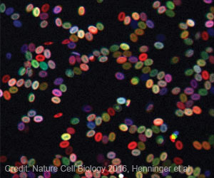 Cell Mechanism Regulating Protein Synthesis in Stress Conditions Identified