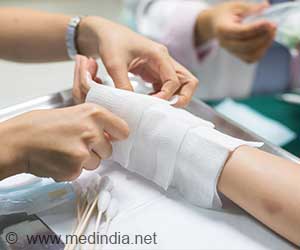  Nerve Tape®: The Suture-Free Future of Nerve Repair