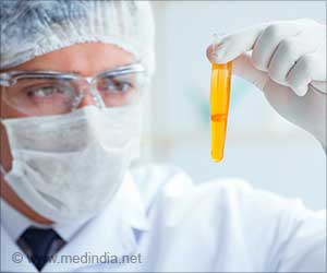 Urinalysis: A Game Changer in Early Cancer Diagnosis