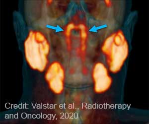 New Glands That Lubricate Our Throat Called Tubarial Salivary Glands Discovered