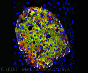 A Brand New Type of Insulin Producing Cells Identified