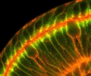 Flip of the Mitotic Spindle Has Disastrous Consequences for Epithelial Cells, Say Researchers