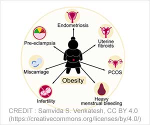 Can Obesity Increase Risk of Female Reproductive Disorders?