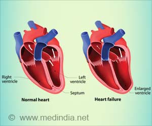 Empagliflozin Downs the Risk of Cardiovascular Death, Hospitalization