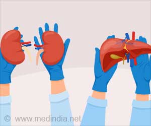 Two Kidneys, One Chance: India's First Dual Kidney Transplant