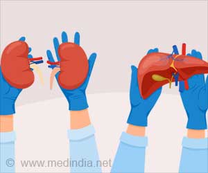 Organ Donation at Manipal Hospital Gives a New Lease of Life to Four
