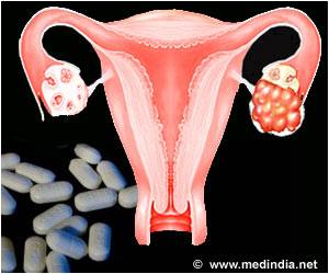  New Drug To Treat Low-grade Ovarian Cancer Found