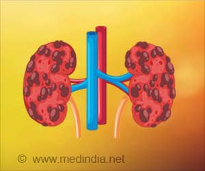 New Meta-analysis Aims to Improve Outcomes in Patients With Severe Chronic Kidney Disease (CKD G4)