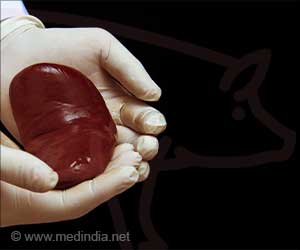 Pig Kidneys for Humans: A New Hope in Organ Transplantion