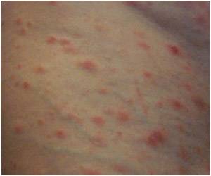  Why Are Skin Diseases Taken So Lightly By People?