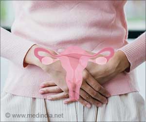 Polycystic Ovary Syndrome Linked to Memory and Cognitive Decline