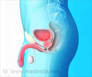 Chemohormonal Therapy Benefits Prostate Cancer Patients