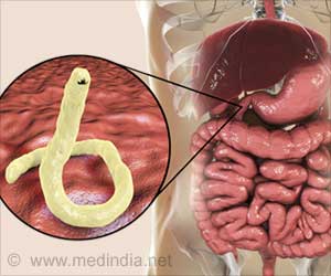 Oral Hookworm Vaccine Developed