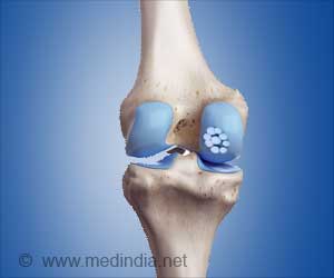 Promising Allograft Transplantation for Knee Pain Among Older Adults