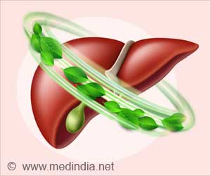 Combatting Fatty Liver: Effective Home Remedies to Protect Your Liver Health
