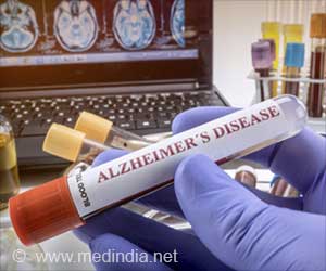 Novel Blood Test With 90% Accuracy Enables Early Detection of Alzheimer's Disease