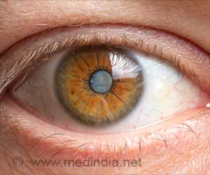 Do Cataracts Go Up When Cholesterol Goes Down?