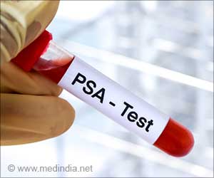 Are Digital Rectal Examinations Accurate in Detecting Prostate Cancer?