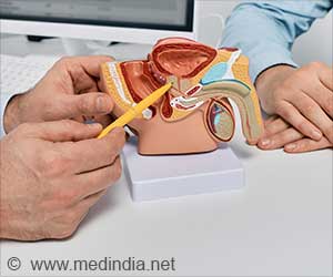 PSA Tests After 70: Are They Always Necessary?