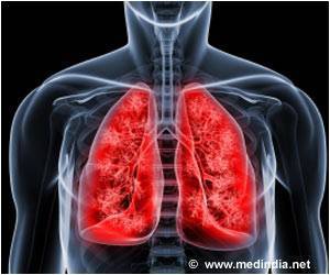  Inhaled Betadine Linked To Rare Lung Inflammation In Children
