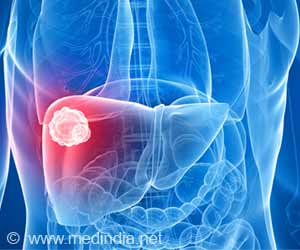 New Radiotherapy Treatment Option for Liver Cancer