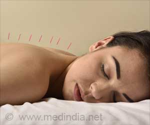 Acupuncture can Reduce Joint Pain in Breast Cancer Patients