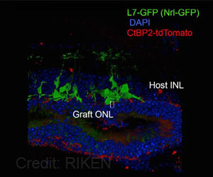 New Transplant Technique May Help Restore Vision In Retinal Degeneration
