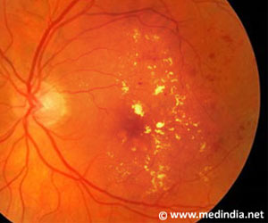 Ideal Lifestyle for Cardiovascular Health also Benefits Eye Health
