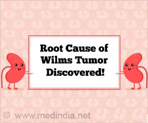 Wilms Tumor: Root Cause of Childhood Kidney Cancer Discovered