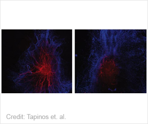 Scientists Find RNA With Special Role in Nerve Healing Process