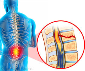 Injury to the Spinal Cord may Affect the Heart