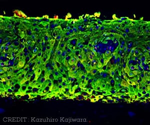 3D Skin from Induced Pluripotent Stem Cells to Treat Spinal Birth Defect