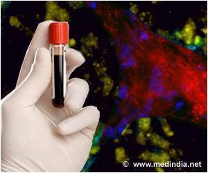 Blood Producing Cells Originate From Ancestor Cells Prior To Birth