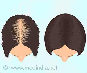 Natural Looking Hair Made From Stem Cells